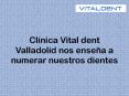 Aprende La Nomenclatura Dental Con Clinica Vital Dent Valladolid PowerPoint PPT Presentation