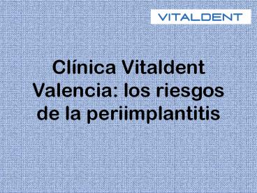 Vitaldent valencia: los problemas de la periimplantitis