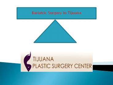 Bariatric Surgery In Tijuana (1)
