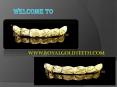Real Gold Teeth (1)