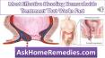 Most Effective Bleeding Hemorrhoids Treatment That Works Fast PowerPoint PPT Presentation