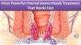 Most Powerful Internal Hemorrhoids Treatment That Works Fast PowerPoint PPT Presentation