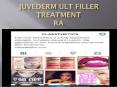 Juvederm Ultra Filler Treatment (1) PowerPoint PPT Presentation