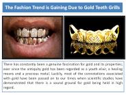 Online Gold Grills Teeth