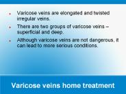 Varicose veins home remedies