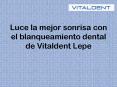 Sonrie gracias al blanqueamiento dental vitaldent Lepe PowerPoint PPT Presentation