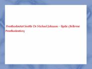 Prosthodontics Seattle, Crowns and Bridges Seattle - Bpdic