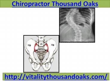 Chiropractor Thousand Oaks (1)