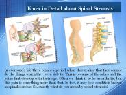Know in Detail about Spinal Stenosis