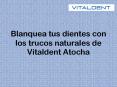 Blanquea Tus Dientes Con Los Trucos Naturales de Vitaldent Atocha PowerPoint PPT Presentation
