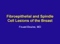Fibroepithelial and Spindle Cell Lesions of the Breast PowerPoint PPT Presentation