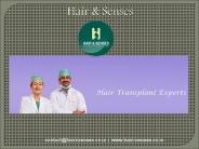 Female Hair Loss