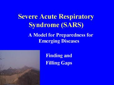 Severe Acute Respiratory Syndrome (SARS)