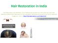 Hair Restoration in India PowerPoint PPT Presentation