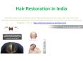 Hair Restoration in Singapore PowerPoint PPT Presentation