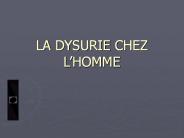 LA DYSURIE CHEZ L
