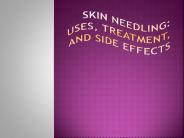 Skin Needling: Uses, Treatment, and Side Effects