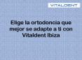 Elige la ortodoncia que mejor se adapte a ti con Vitaldent Ibiza PowerPoint PPT Presentation