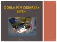Doula for Cesarean Birth PowerPoint PPT Presentation