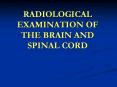 RADIOLOGICAL EXAMINATION OF THE BRAIN AND SPINAL CORD PowerPoint PPT Presentation