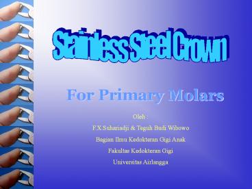 Stainless Steel Crown