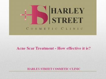 Acne Scar Treatment - How effective it is?