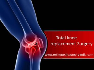 Total knee replacement surgery in Delhi