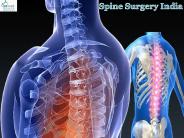 Spine Surgery in India