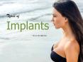 Breast Augmentation in Los Angeles - Enhance your Body Shape PowerPoint PPT Presentation
