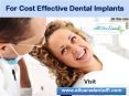 All Care Dental - Highly Sophisticated Dental Implants Done Here PowerPoint PPT Presentation