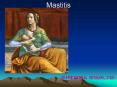 Mastitis PowerPoint PPT Presentation