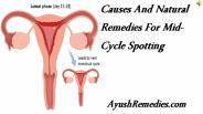 Causes And Natural Remedies For Mid-Cycle Spotting