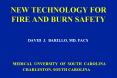 NEW TECHNOLOGY FOR FIRE AND BURN SAFETY PowerPoint PPT Presentation