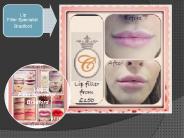 Lip Filler Specialist Bradford (1)