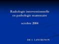 Radiologie interventionnelle en pathologie mammaire octobre 2004 PowerPoint PPT Presentation
