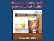 Dental Implants India for the cure