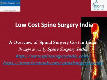 Low Cost Spine Surgery India