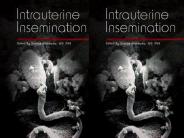 Intrauterine Insemination Treatment