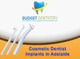Cosmetic Dentist Implants in Adelaide PowerPoint PPT Presentation