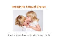 Incognito Lingual Braces