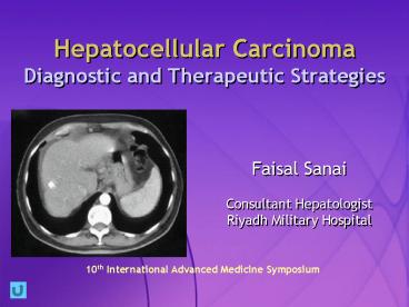 Hepatocellular Carcinoma Diagnostic and Therapeutic Strategies