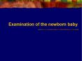 Examination of the newborn baby PowerPoint PPT Presentation