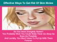 Effective Ways To Get Rid Of Skin Moles PowerPoint PPT Presentation