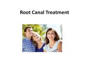 Root Canal Treatment