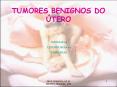 TUMORES BENIGNOS DO  PowerPoint PPT Presentation
