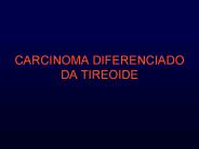 CARCINOMA DIFERENCIADO DA TIREOIDE
