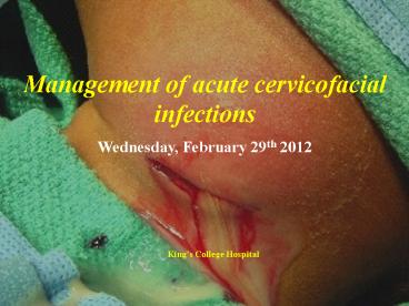 Management of acute cervicofacial infections