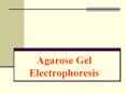 Agarose Gel Electrophoresis PowerPoint PPT Presentation