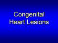 Congenital Heart Lesions PowerPoint PPT Presentation