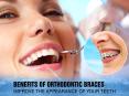 Brace your teeth by the expert Orthodontist in San Diego PowerPoint PPT Presentation